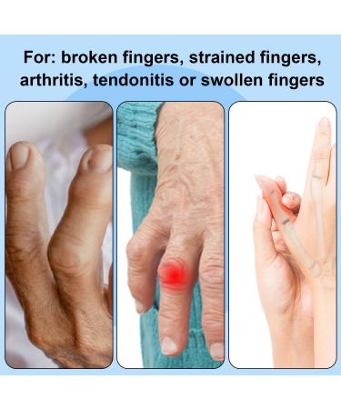 SAREAL 9Pcs Trigger Finger Splints & Sleeves Kit - Pain Relief for Trigger Finger Adjustable Straps & Black Finger Sleeves International Shipping Available - Buy Online on GoSupps.com