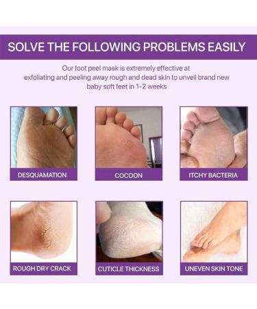 2Pairs Lavender Feet Peeling Socks Foot Moisturiser Socks Foot Masks Remove Hard Skin Callus Remover For Feet Foot Mask For Dry Cracked Feet Exfoliating Foot Peeling Mask For Hard Skin Hand Foot Mask - Buy Online on GoSupps.com