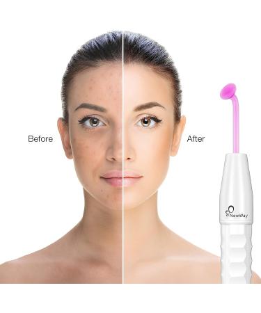 NewWay High Frequency Therapy Wand Machine with 4 Argon | Skin Tightening, Hair Follicle Stimulation, Facial Beauty Treatment - Buy Online on GoSupps.com