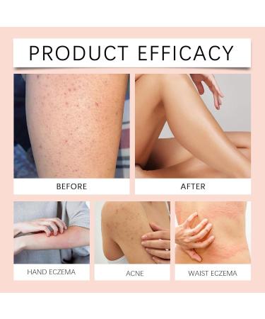  KOAHDE Sebum and honey balm firming and moisturizing sebum face cream sebum skin care cream sebum for the skin 120 g - Buy Online on GoSupps.com