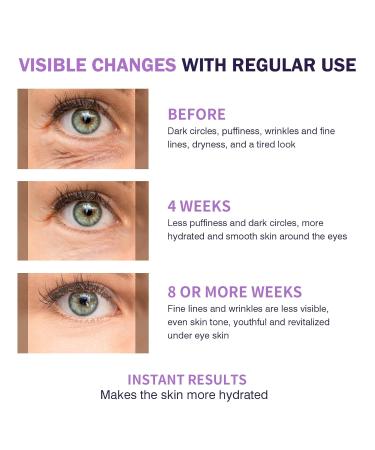 Eye Serum with 5% Mate Caffeine Under Eye Cream for Puffy Bags Fine Lines Dark Circles Wrinkles 360 Roller Massage Ball Eyes Treatment Serum Brightens Tired Eyes 5ml 0.5 fl. oz - Buy Online on GoSupps.com