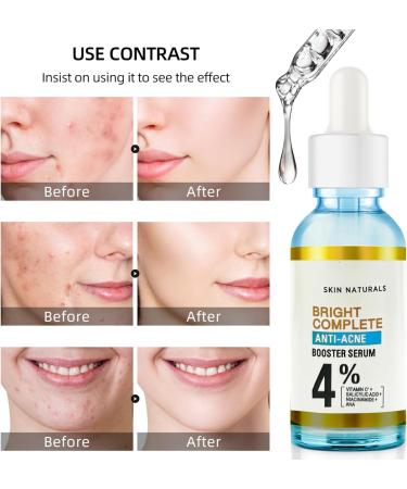 Faded Topicals for Dark Spots - Salicylic Acid Serum - Dark Spot Correcting Glow Serum - Moisturizing Niacinamide Serum with Vitamin C - Dark Spot Remover for Face - Removing Acne and Controlling Oil - Buy Online on GoSupps.com