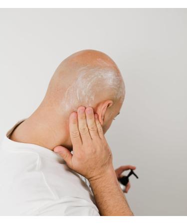 OnlyBalds Exfoliating Scalp & Face Cleanser 10 oz Aluminum Bottle Premium Daily Cleanser for Bald Men & Women Shaved Heads Alopecia Care & Shave Prep Fragrance-Free Dermatologist Tested - Buy Online on GoSupps.com