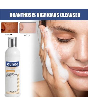 Cleansing Lotion for Acne & Spots | Acanthosis Nigricans Treatment Set - Salyzap Body Wash, Nigrifree Cream, Therapy Oil | 50ml - 1 Count (Pack of 2) - Buy Online on GoSupps.com