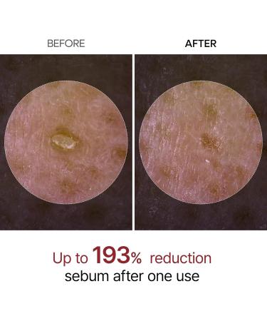 Dr.Melaxin Ampoule Gommage claircissant au Riz Blanc limination des Cellules Mortes de la Peau Exfoliant Doux pour Visage et Corps Pour Tous les Types de Peau Soin de la Peau Cor en 80ml - Buy Online on GoSupps.com