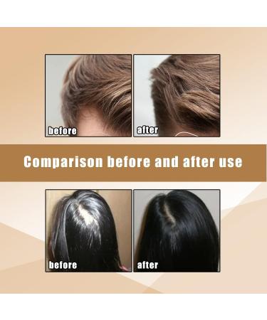 Ginger Shampoo Soap Hair Regrowth Shampoo Bar Anti Hair Loss Solid Shampoo Soap Repair Damaged Hair and Promote Hair Growth - Buy Online on GoSupps.com