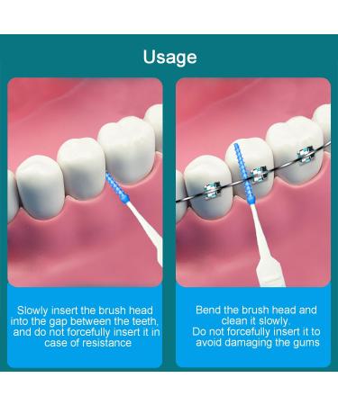 200 Interdental Brushes - Silicone Tooth Cleaning Gaps Set | Narrow Teeth Care | Oral Health Essentials (Blue) - Buy Online on GoSupps.com