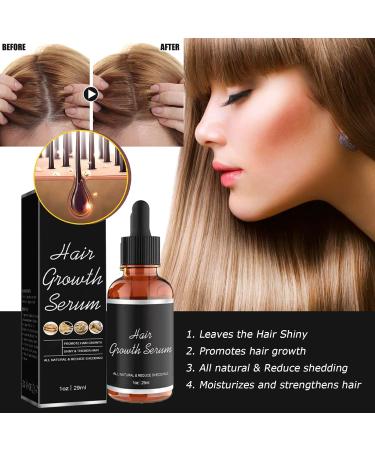 Hair Growth Serum Ginger Hair Oil for Hair Growth Hair Serum Strengthen Hair Roots for Thinning Balding Hair Hair Growth Oil Thickening Stronger Repairs Nourishes for Women Men Hair Care-29ML - Buy Online on GoSupps.com