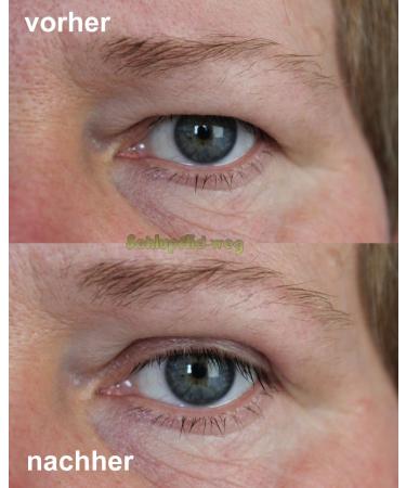 Buy MAGIC Invisible Girl Size S - Eyelid Lifting Without Surgery (1x60 Pairs) | International Shipping Available - Buy Online on GoSupps.com