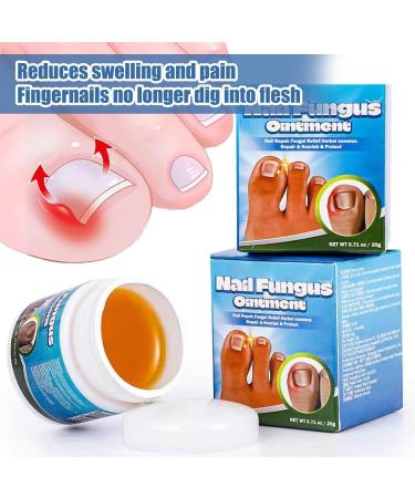 Soins des ongles de pied endog nes Cr me r paratrice pour les ongles Ongles R parateurs Renforce Les Ongles Favorise La Repousse D'ongles Sains Cr me professionnelle pour le soin des pieds(20g) - Buy Online on GoSupps.com