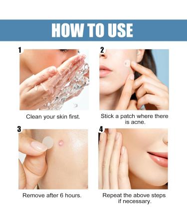 Pimple Patches Acne Stickers Hydrocolloid Patches Large Acne Stickers for Face Chin or Body Effectively Calms & Relieves Acne (80 Patches) - Buy Online on GoSupps.com