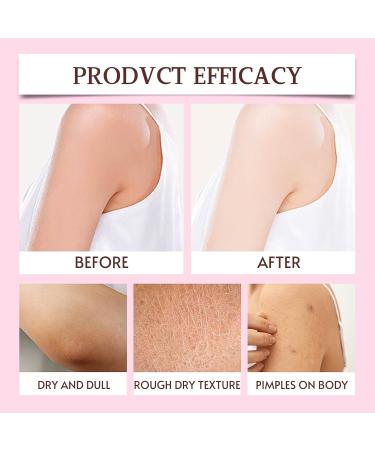 After Bath Vitamin C Brightening Body Lotion Spf Body Moisturiser Vitamin C Body Lotion For Dry Skin Body Lotion Women Anti Aging & Skin Lightening Cream For Body Uneven Skin Tone Sun Damaged - Buy Online on GoSupps.com