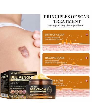 Bee Venom Skin Restoration cream Bee Venom Skin Treatment Cream Softens and rejuvenates skin - and reduces imperfections (4PCS) - Buy Online on GoSupps.com