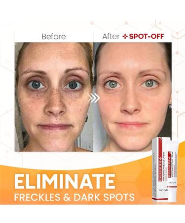 Spot Off Freckle Whitening & Dark Spot Corrector Cream - Acne Scar & Melasma Removal Treatment for Face (2 Pcs) - Buy Online on GoSupps.com