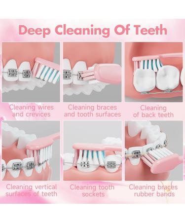 V-Shaped Orthodontic Toothbrush for Braces - 6 Count Ultra Soft Bristle Toothbrushes with Head Covers for Teens & Adults - Pink Braces Toothbrush Set - Buy Online on GoSupps.com