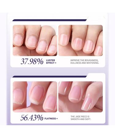 Huile Cuticules Ongles Stylo pour R parer les Fissures et l'huile de Cuticule S che 2 en 1 Limes a Ongles Huile A Cuticule Ongle Riche en vitamines e Polissoir a Ongle de Traitement (1) - Buy Online on GoSupps.com