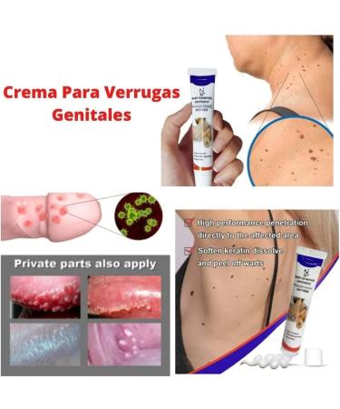 2023 New Herpes & Wart Ointment - Genital & Vulva Treatment for Condyloma Acuminatum (20g) - Fast International Shipping - Buy Online on GoSupps.com