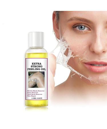 Yellow Peeling Oil Peeling Oil for Dark Skin Strong Peeling Oil Extra Strength Exfoliating Peeling Solution for Body All Skin Type Dead Skin Remover (3.87 Fl Oz / 110ML)