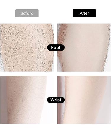 Vliese Strips for Warm Wax & Sugar Paste - 300 Skin-Friendly Fleece Depilatory Strips for Legs Face & Intimate Areas | Tear-Resistant & Versatile - Buy Online on GoSupps.com