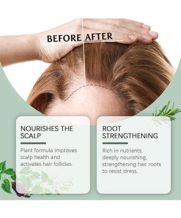 Rosemary Hair Spray Organic Rosemary Oil for Hair Growth Natural Rosemary Hair Oil Smooth & Soft Hair 100ml Rosemary Extract with Castor Seed Oil Prevents Hair Loss and Soothes Scalp - Buy Online on GoSupps.com