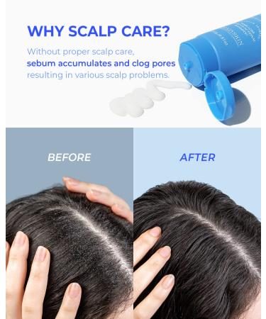 CRAZY SKIN Antarctica Sea Salt Scalp Ice Shampoo | Clarifying & Exfoliating for Healthy Hair Growth | 250ml for Dry Itchy & Oily Scalp - Buy Online on GoSupps.com