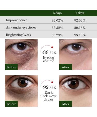 Under Eye Patches Avocado Eye Masks for Puffy Eyes Collagen Eye Patches for Dark Circle Under Eye Gel Patches Under Eye Mask Under Eye Bags Fine Lines & Wrinkles Hydrating Skincare 30 Pairs - Buy Online on GoSupps.com