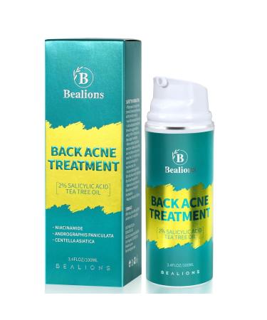 Bealions Back Acne Treatment  2% Salicylic Acid Back Acne Treatment with Tea Tree oil  Hormonal Acne And Cystic Acne Treatment For Body  Butt and Back  Acne Solution For Teens  Women And Men