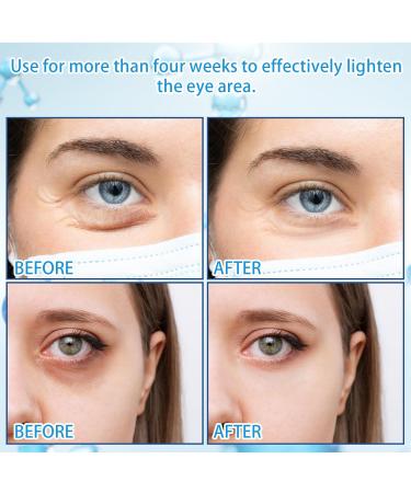Buy 5% Caffeine Eye Serum - 360 Massage Rollerball for Dark Circles Puffiness & Wrinkles | Best Under Eye Cream for Men & Women - Buy Online on GoSupps.com