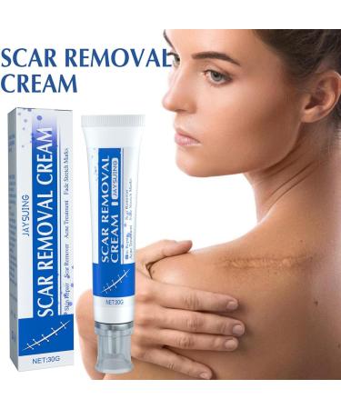  smashing Stretch Mark Cream | 30g Soothing Scar Cream for Hyperplasia | Effective Scar Smoothing for Old and New Scars | Stretch Mark Removal Cream for Men | Smashing - Buy Online on GoSupps.com