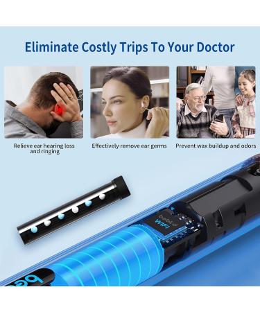 Bebird Pro Note3 Ear Wax Removal Tool | 10MP HD Otoscope with Light | Ear Camera & Tweezers 3-in-1 | Navy | for iPhone & Android - Buy Online on GoSupps.com
