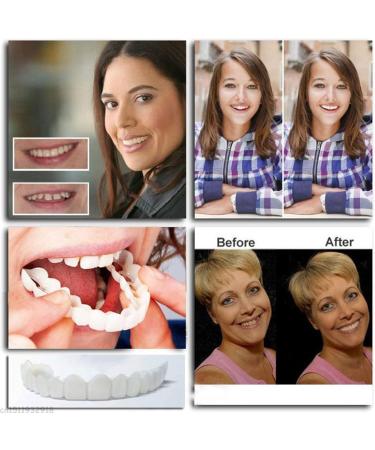 Mxrfactory Teeth Prosthesis - Pebble Gel Snap-On Smile Temporary Cosmetic Tooth Set | 14 Removable Pairs for Instant Smile & Braces Cover - Buy Online on GoSupps.com