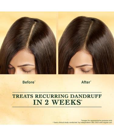 Indu..lekha Sve..tak..utaja Scalp Serum Dandruff Treatment Silicone & Paraben Free Ayurvedic Formula - Buy Online on GoSupps.com