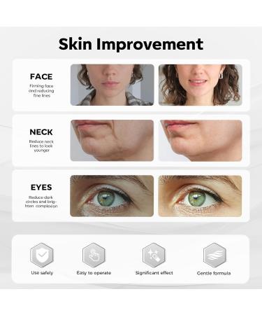 SHINING FACE Micro Infusion Skincare System - 0.25mm Facial Stamp with Collagen Peptide & Hyaluronic Acid Serum At Home Glow- 3 Month Supply - Buy Online on GoSupps.com