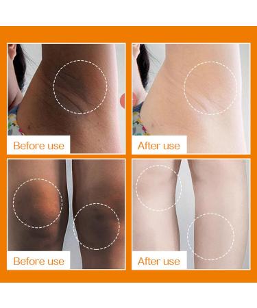 Generisch Moisturizing Body Cream Non Greasy Skin Lotion | Brightening Body Cream for Daily Care of Arms Neck Elbow and Knees for Men and Women - Buy Online on GoSupps.com