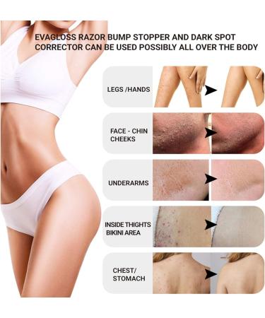 100ml Beard Growth Inhibitor & Ingrown Hair Solution for Razor Burns - After Shave Repair Serum - Buy Online on GoSupps.com