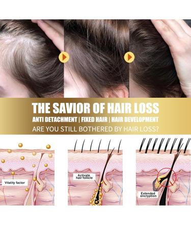 50g Hair Scalp Exfoliating Scrub Anti Hair Loss Treatment for Dandruff Flakes & Oily Scalp Nourishes Hair Follicles & Promotes Thicker Healthier Hair Growth - Buy Online on GoSupps.com