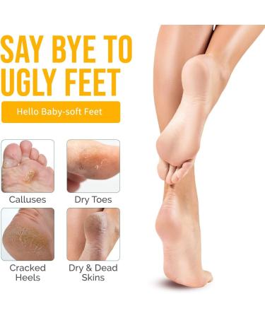 Extra Strong Peeling Oil Yellow Peeling Oil for Dark Skin Natural Formula Exfoliating Peels Solution for Face Body Hands and Foot Dead Skin Remover (220ML/7.76 OZ) - Buy Online on GoSupps.com