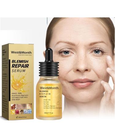 Freckle Repair Essence Anti-Wrinkle Rejuvenation Whitening Skin Fades Facial Wrinkles Fine Lines Spots 30ml - Buy Online on GoSupps.com
