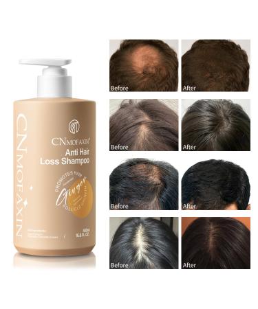 Anti Hair Loss Shampoo - Nourishing Ginger Hair Growth Treatment for Men & Women | Volumizing Regrowth with Herbal Essences Rose & Castor Oil - 16.8 fl. oz - Buy Online on GoSupps.com