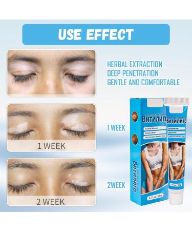  Encuryna Gentle skincare cream with plant extracts - Natural formula for a more even complexion - Intensive care to strengthen the skin barrier and balance the skin - Suitable for all skin types - Buy Online on GoSupps.com