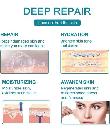 Silicone Scar Sheets 1.6 x 60 - Surgical C-Section Keloid Acne Burn Scars Tape - Buy Online on GoSupps.com