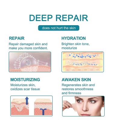 Medical Silicone Gel Tape for Scar Removal - Hypertrophic & Keloid Scars - Pain-Free & Water-proof - 1.6 x 60 - Buy Online on GoSupps.com