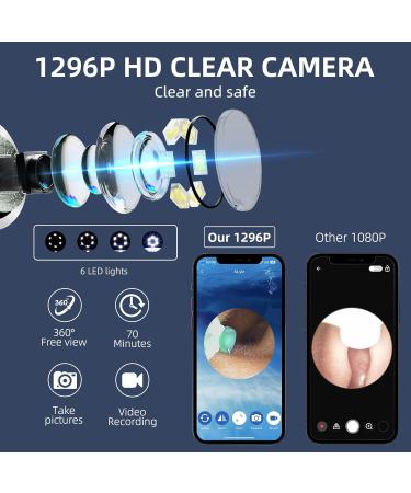 AVM NE3 Ear Wax Removal Kit - 1296p HD Wireless Endoscope with App Control Waterproof 8 Ear Cleaners for Kids Adults & Pets - iOS & Android Compatible - Buy Online on GoSupps.com