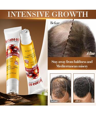 Batana Scalp Soothing Dense Hair Conditioning Rollers 2 pieces Organic hair oil for faster hair growth stronger roots and less hair loss for all hair types nourishing hair oil - Buy Online on GoSupps.com