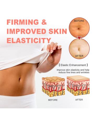 Body Serum for Firming and Tightening Anti-Aging & Anti-Wrinkle Body Serum Moisturizer with Hyaluronic Acid B5 and Shea Butter Tighten and Lift Serums 100Ml/3.38 Fl Oz - Buy Online on GoSupps.com