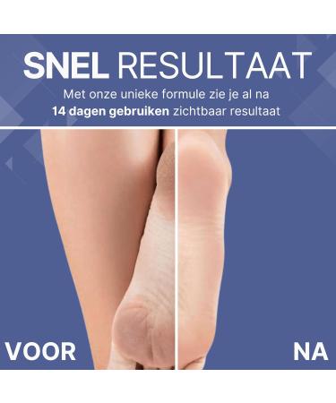 Arcim Healthcare BV Calluses and Cracks Cream Callus Cream with Urea Squalane Provitamin B5 Callus Remover for All Skin Types Cracked Ointment for Feet and Hands Against Cracked Heels 100 ml Tube - Buy Online on GoSupps.com