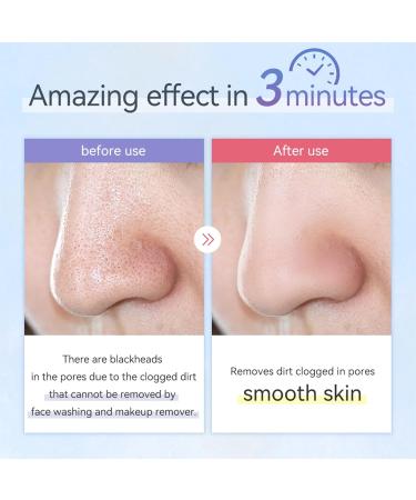 Blackening Remover & Skin Scrubber - Ultrasound Peeling Pore Cleaner Waterproof Acne Treatment | Facial Care & Massage - Buy Online on GoSupps.com