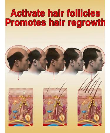 Natural Hair Growth Essential Oil 10ML | Fast Baldness & Hair Loss Repair | Herbal Extracts for Hereditary & Postpartum Hair Loss - Buy Online on GoSupps.com