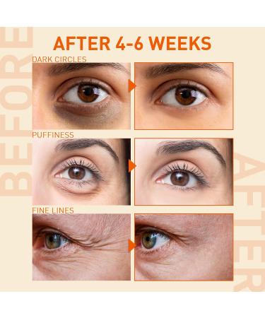 Under Eye Serum for Puffiness & Dark Circles | Caffeine Treatment for Eye Bags & Wrinkles - Fast Results in 2 Weeks - Buy Online on GoSupps.com
