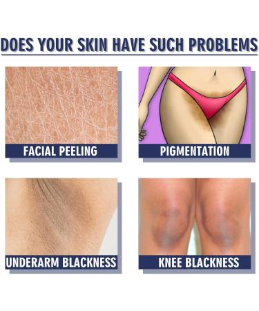 leryveo Whitening Cream - Fast Absorbing Underarm Whitening Cream | Brightening Cream for Underarms Neck Armpits Knees Elbows and Intimate Zs - Buy Online on GoSupps.com